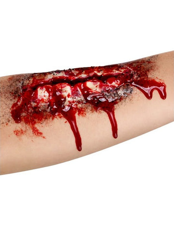 Фалшива рана отворена предмишница